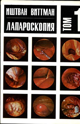 Лапароскопия  | В двух томах. Том 1, 2. - фото 139745