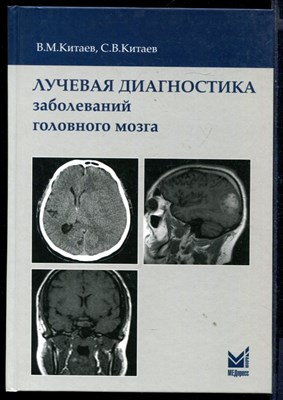 Лучевая диагностика заболеваний головного мозга - фото 146279