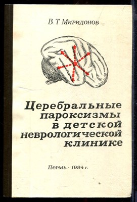 Церебральные пароксизмы в детской неврологической клинике - фото 167068