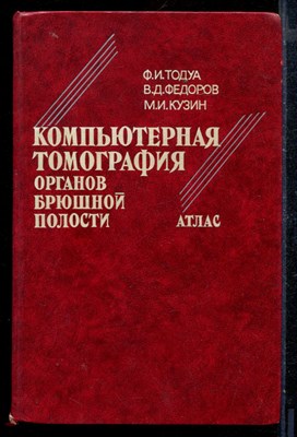 Компьютерная томография органов брюшной полости | Атлас. - фото 171623