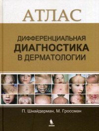 Дифференциальная диагностика в дерматологии Атлас - 2017 - фото 198046