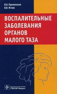 Воспалительные заболевания органов малого таза - фото 198133