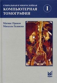 Спиральная и многослойная компьютерная томография Том 1 - фото 198296