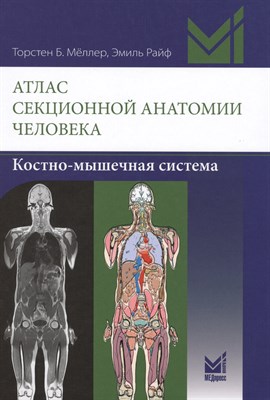 Меллер - Атлас секционной анатомии человека Костно мышечная система - 2017 - фото 213597