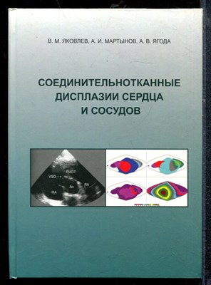 Яковлев В.М., Мартынов А.И., Ягода А.В. - Соединительнотканные дисплазии сердца и сосудов - 2010 - фото 219151