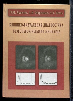Яковлев В.М., Мартынов А.И., Ягода А.В. - Клинико-визуальная диагностика безболевой ишемии миокарда - 2012 - фото 219152