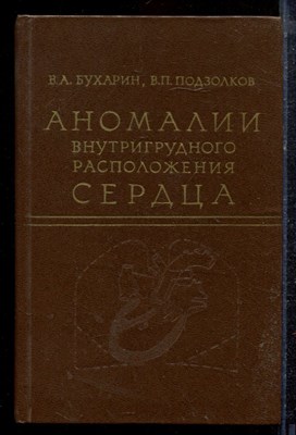 Бухарин В.А., Подзолков В.П. - Аномалии внутригрудного расположения сердца - 1979 - фото 220364