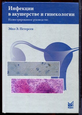 Петерсен Э.Э. - Инфекции в акушерстве и гинекологии - 2007 - фото 223709