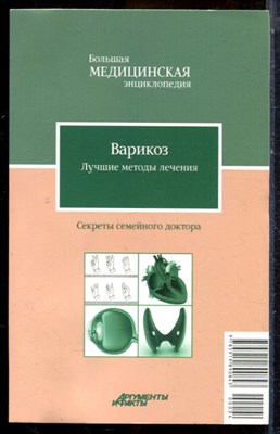 Варикоз. Лучшие методы лечения | Серия: Большая медицинская энциклопедия: Секреты семейного доктора. - 2012 - фото 225056