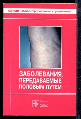 Заболевания, передаваемые половым путем - 1998 - фото 226390