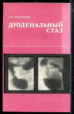 Мирзаев А.П. - Дуоденальный стаз - 1976 - фото 226620