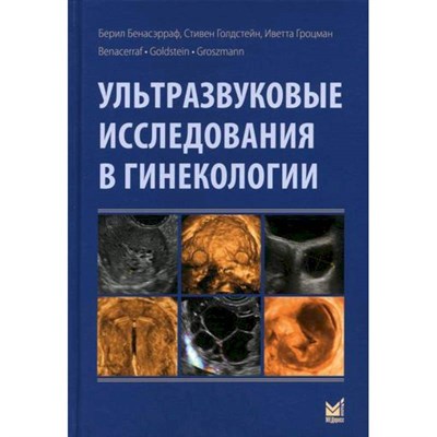 Бенасэрраф Б. - Ультразвуковое исследование в гинекологии - 2020 - фото 231307