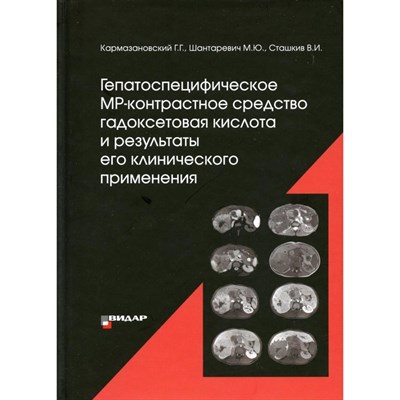 Кармазановский Г. - Гепатоспецифическое МР-контрастное средство гадоксетовая кислота и результаты его клинического приме - 2022 - фото 241170