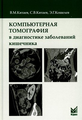 Китаев - Компьютерная томография в диагностике заболеваний кишечника - 2020 1353413 - Р