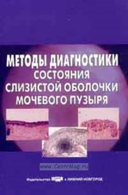 Стрельцова - Методы диагностики состояния слизистой оболочки мочевого пузыря - 2007 1323385 - Р