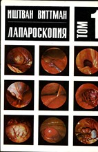 Лапароскопия  | В двух томах. Том 1, 2.