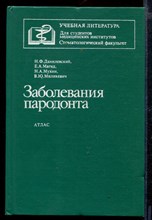 Заболевания пародонта | Атлас.