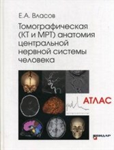 Томографическая КТ и МРТ анатомия центральной нервной системы человека