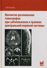 Магнитно резонансная томография при заболеваниях и травмах центральной нервной системы