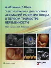 УЗД аномалий развития плода в первом триместре беременности - 2019 УЗД аномалий развития плода в первом триместре беременности - 2019
