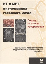 Шотемор Ш.Ш. - КТ и МРТ визуализация головного мозга - 2016 Шотемор Ш.Ш. - КТ и МРТ визуализация головного мозга - 2016