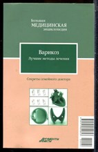 Варикоз. Лучшие методы лечения | Серия: Большая медицинская энциклопедия: Секреты семейного доктора. - 2012
