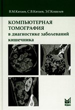 Китаев - Компьютерная томография в диагностике заболеваний кишечника - 2020 1353413 - Р